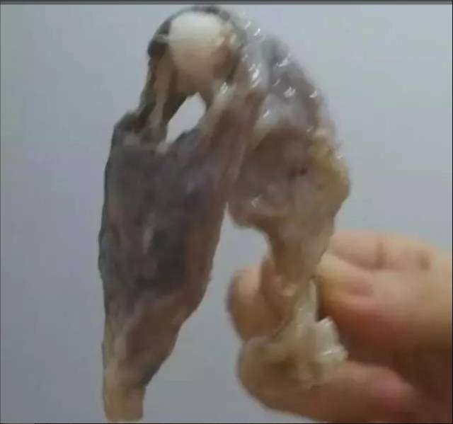 看了这些图片,赶紧找个好产品给子宫排毒吧!