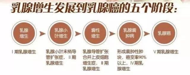 每4个乳腺增生患者就有一个可能发展为乳腺癌.