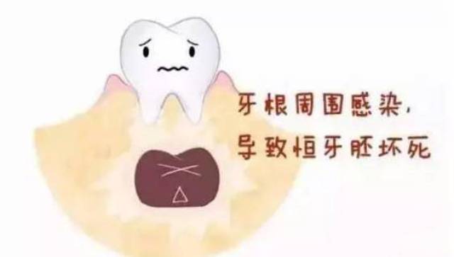 导致宝宝恒牙长不出,或者一长出来就有缺损.