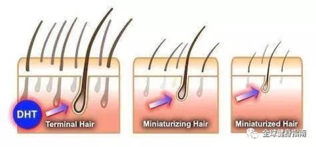 健身会脱发!?跳肚皮舞呢?