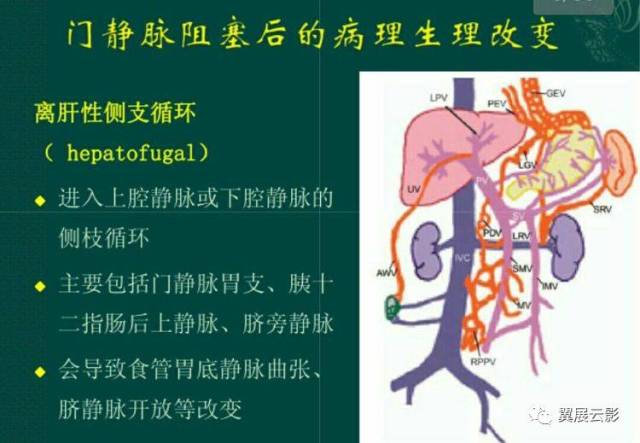 其次亦应与腹腔结核,消化道阻塞及肿瘤等所致的腹水及下肢静脉曲张相