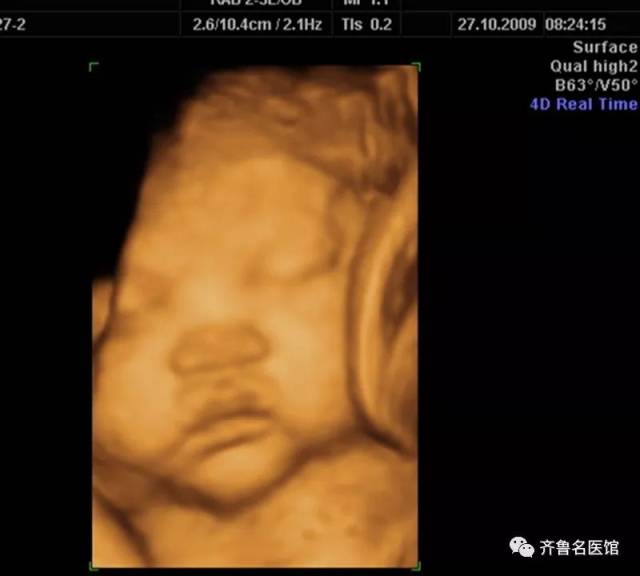 指导专家 济南市妇幼保健院特检科主任,主任医师 王月美