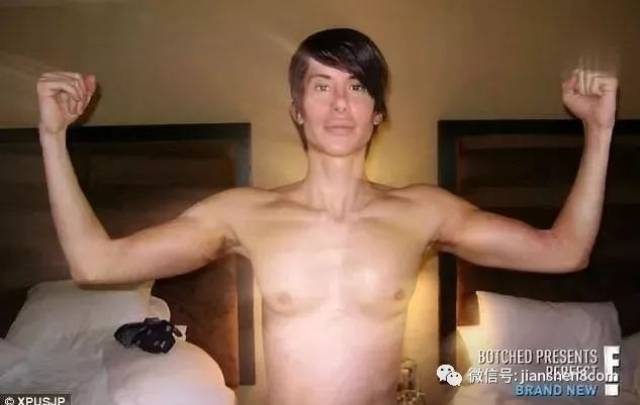 男子花百万整形成“肌肉男”，这是妖精还是人