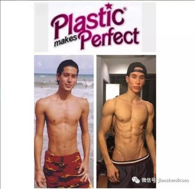 男子花百万整形成“肌肉男”，这是妖精还是人