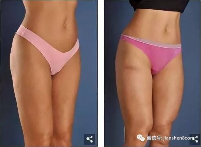 男子花百万整形成“肌肉男”，这是妖精还是人