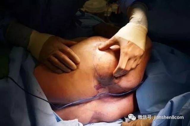 男子花百万整形成“肌肉男”，这是妖精还是人