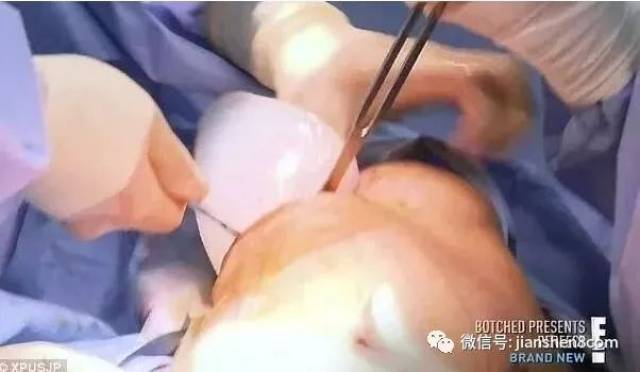 男子花百万整形成“肌肉男”，这是妖精还是人