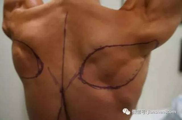 男子花百万整形成“肌肉男”，这是妖精还是人
