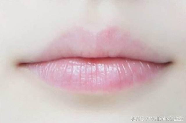 喝多少水嘴唇都发干怎么办 089da93f129b49b7b6501b7c5522dd40.jpeg