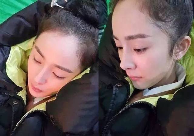 杨幂被吐槽发际线高头发少?如果有了这些日本好物他们