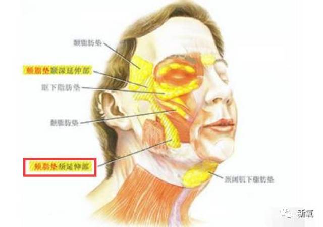 颊脂垫的主要作用是支撑面颊部皮肤,使得面颊饱满圆润.