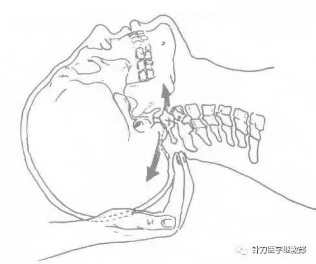 后枕部疼痛你要了解的几块肌肉和自我解决办法