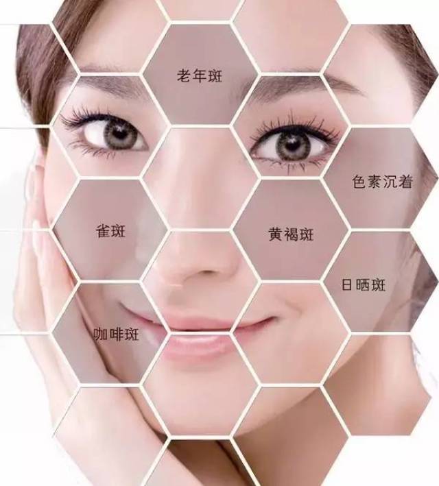皮秒祛斑效果有那么神?我有点不太相信