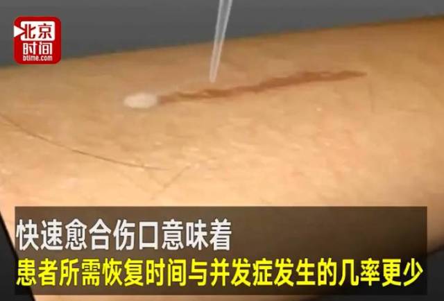 惊呆!科学家用胶水粘伤口,不用缝针60秒愈合,人类的福音!
