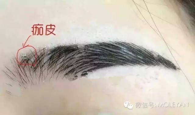 眉毛脱痂后颜色淡?别担心,过了返色期让你更美丽!