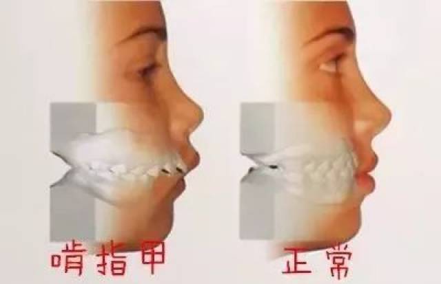 梦见自己的手被自己的头发烫伤了，潜意识中的警示与内心冲突的解析