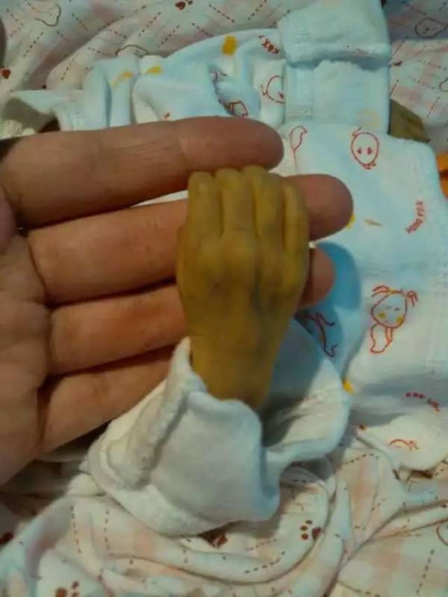 2个月前,一个在妈妈肚子里仅待了29周 2天的小宝宝,匆忙降临到这个