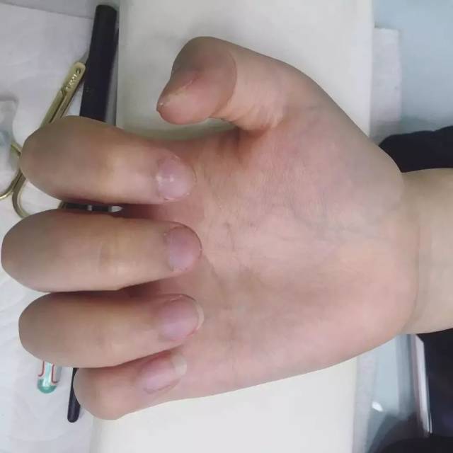 啃指甲竟然会让人变丑!看完你还敢啃指甲吗?
