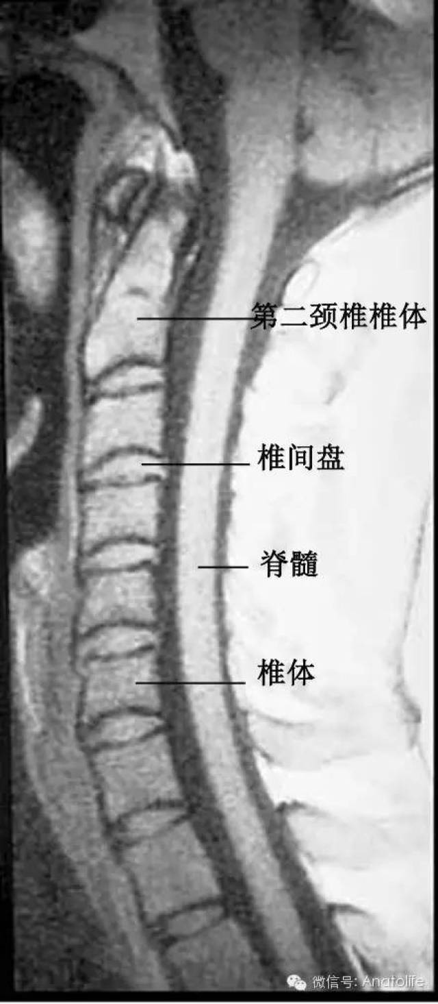 与颈椎病有关的解剖学知识