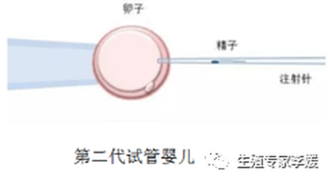 而第三代试管婴儿是在胚胎培养阶段,将卵裂期或囊胚期胚胎的单个或多