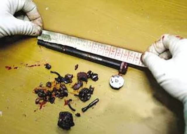 可怕！辦公椅突然爆炸
派辦公家具，擊穿電腦機(jī)箱！頻發(fā)事