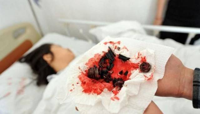 可怕！辦公椅突然爆炸
派辦公家具，擊穿電腦機(jī)箱！頻發(fā)事