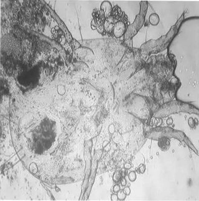 45倍显微镜下的螨虫