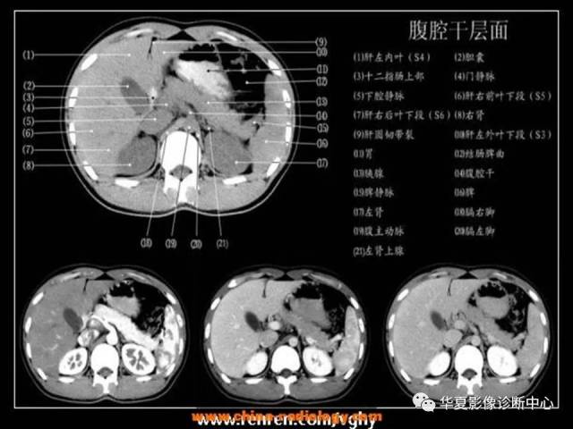 读懂腹部ct解剖,只花1小时