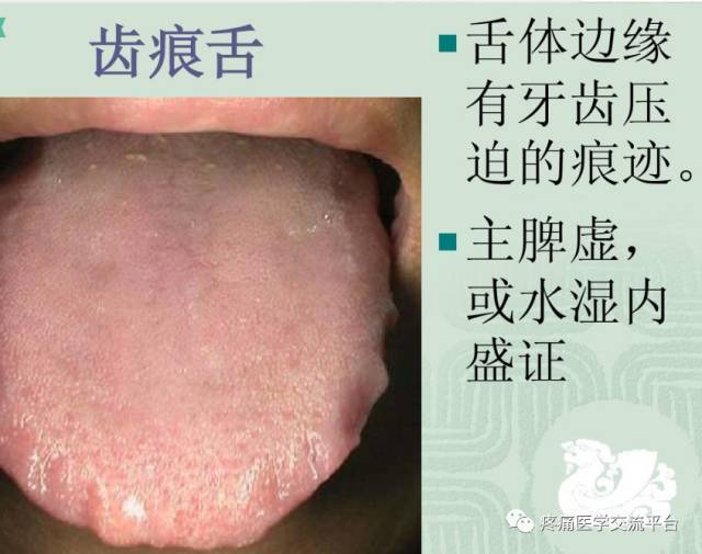 (收藏)中医舌诊图文