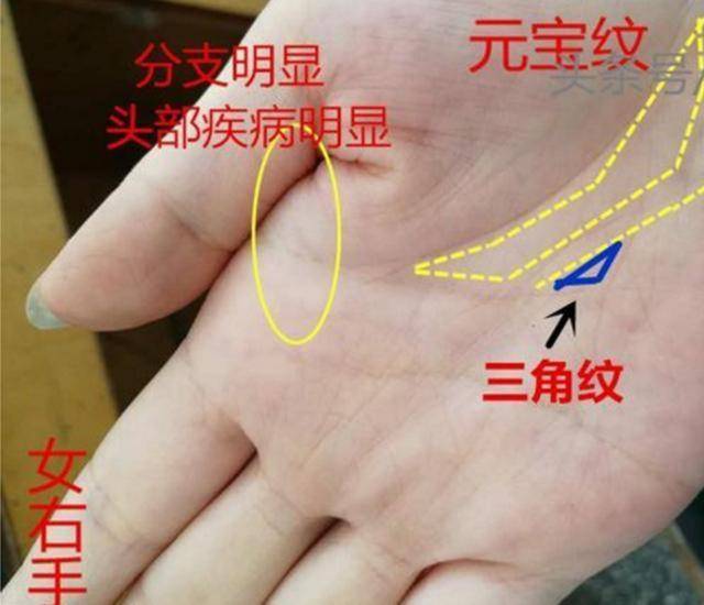 泰安算命 手相三角纹好不好看长在哪里,一种有财,一种身体有疾病_手机