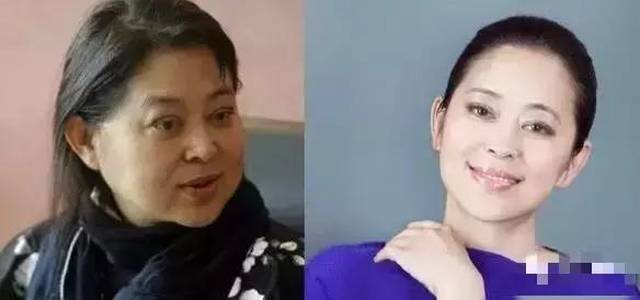 整形到底要不要趁早呢？