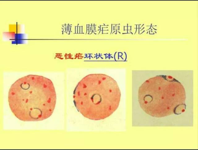 尿液管型图片分享,细胞图片分享疟原虫专辑