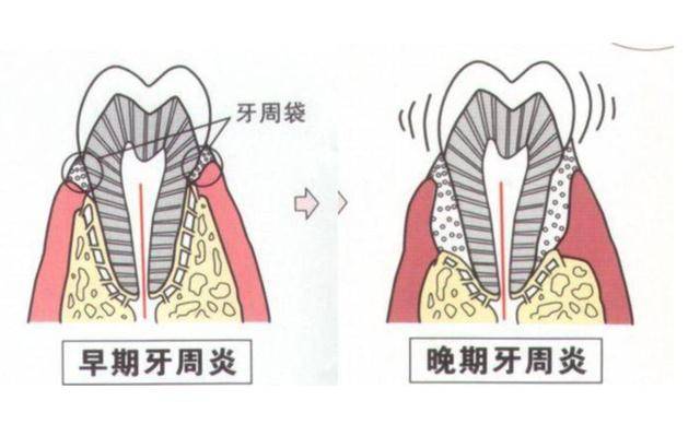 糖尿病人口苦是怎么.._澳洲又出黑科技 世界第一台人工胰岛素泵 实时监控血糖