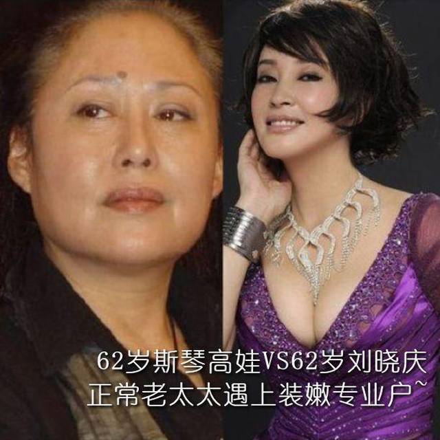 整形到底要不要趁早呢？