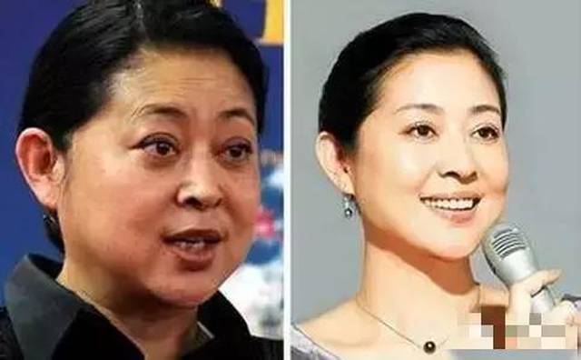 整形到底要不要趁早呢？