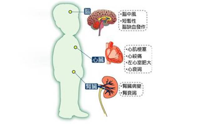 继发性高血压如原发性醛固酮增多症,嗜铬细胞瘤,肾动脉狭窄,妊娠高