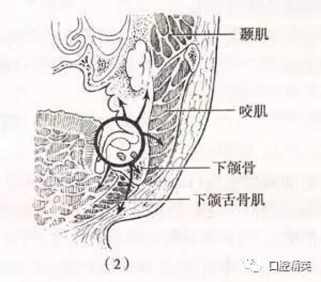 以下扩散途径 感染向前方,顺外斜线在第一磨牙颊侧前庭沟处形成脓肿