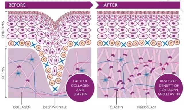 以色列人果然最懂黑科技？！发明了一个美容仪