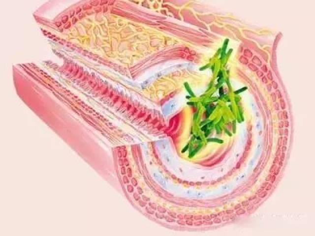 肠道被称为身体"最劳累的器官"
