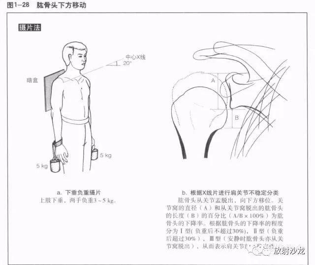 详细的肩关节x线解剖 发育 摄影技巧 测量方法