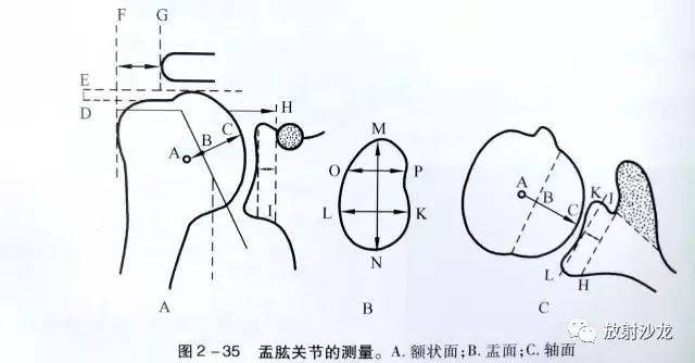 详细的肩关节x线解剖 发育 摄影技巧 测量方法