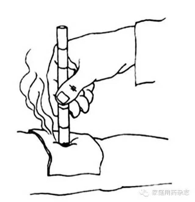 用好"艾灸",保健养生