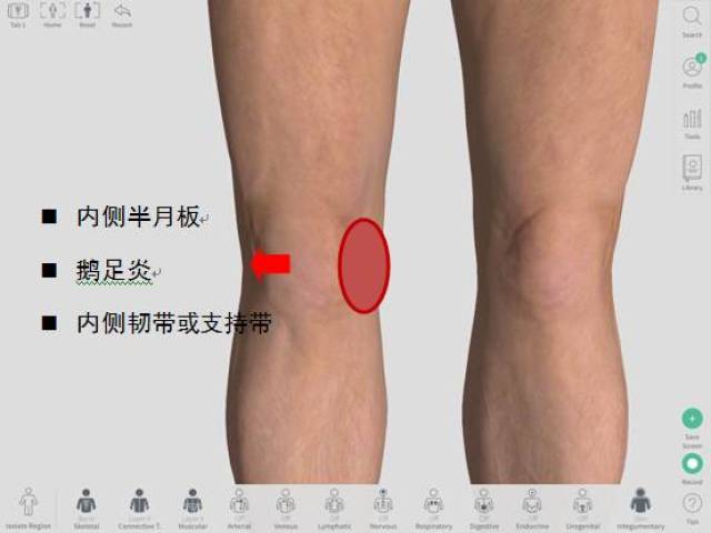 【膝痛】一分钟搞懂你的"膝盖痛"