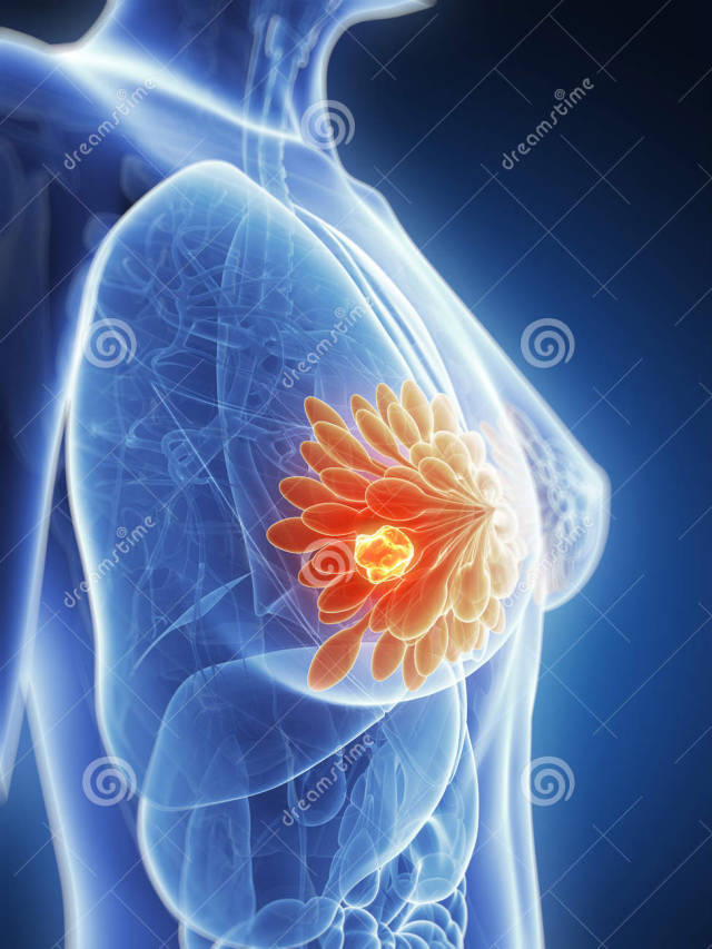 乳腺癌,卵巢癌与基因那些事儿