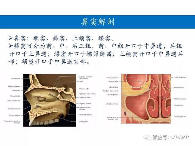 鼻腔鼻窦解剖及常见病变影像诊断(一)