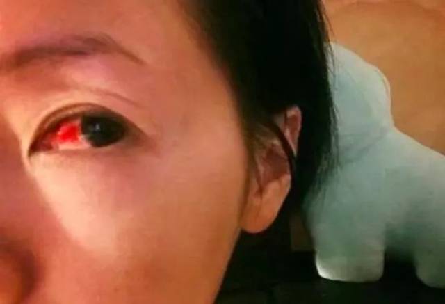 眼角细节出卖小s真实婚姻生活,家暴淤青分房睡一样不少!