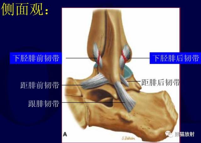 下胫腓联合远端韧带结结构,包括:骨间韧带(iol),下胫腓前韧带(aitfl)