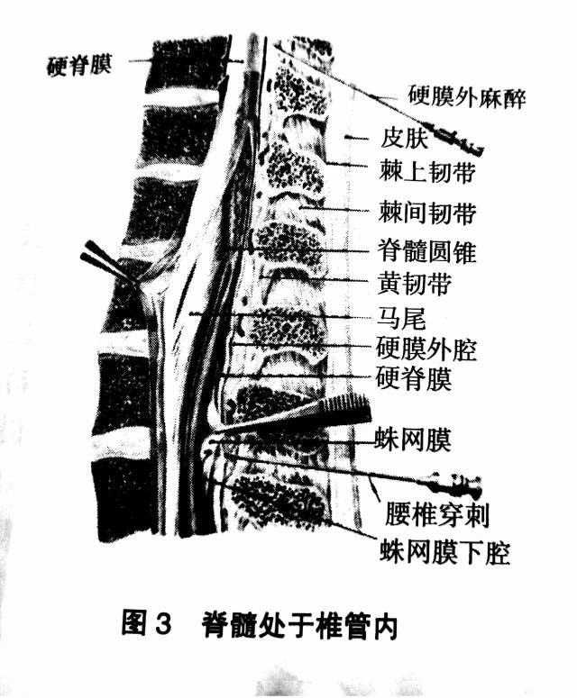 脊髓外包三层膜,自外向内以此为硬膜,蛛网膜和软膜,借齿状韧带和神经