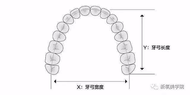使用专用的牙弓矫正器就可以,可以 扩弓也可以 缩弓,看个人需求.▼