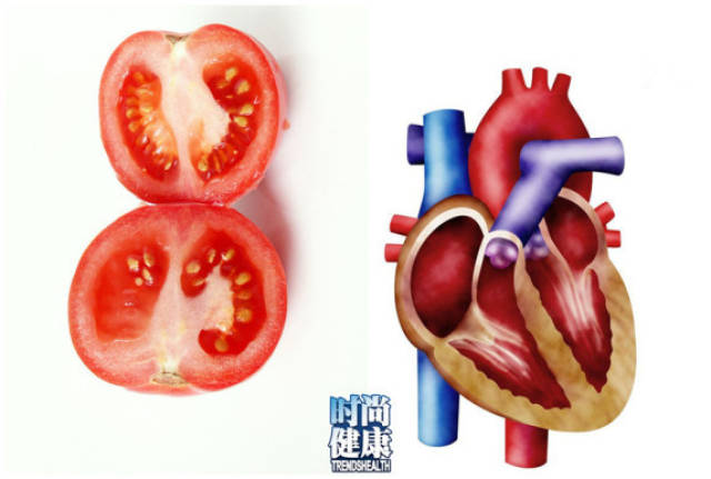 吃什么东西能降低血管疾病 7c73146883694d0490aa3c3674a2a105.jpeg